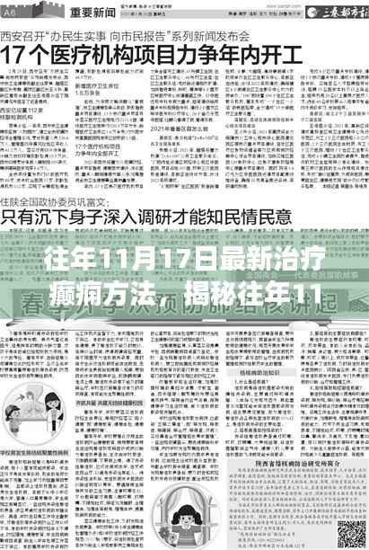 揭秘癫痫治疗新进展,前沿科技引领革新之路(往年11月17日最新治疗方法)