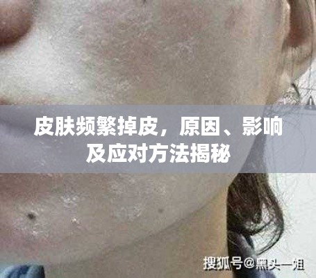 皮肤频繁掉皮,原因、影响及应对方法揭秘