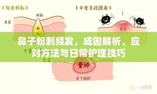 鼻子粉刺频发，成因解析、应对方法与日常护理技巧