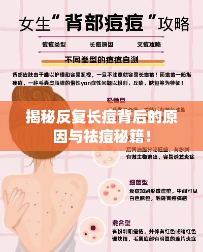 揭秘反复长痘背后的原因与祛痘秘籍!